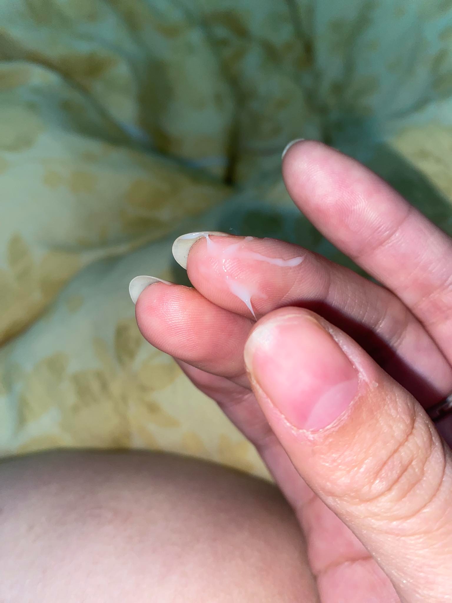 Khí hư trắng, dai và kéo sợi có phải bị viêm không? 2 695f57c021597 khi hu