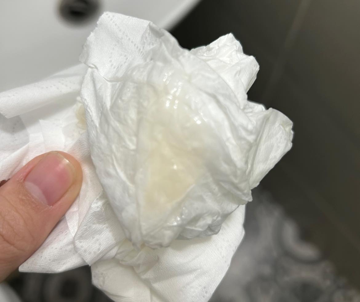 Ra dịch nhầy và quan hệ hơi đau, khô có sao không? 2 626938066 2170309240376313 7845668124099299271 n