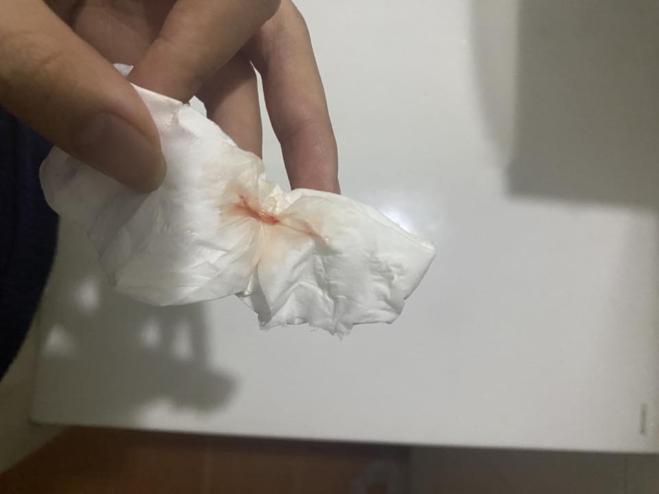 Ra máu giữa chu kỳ có phải rụng trứng không? 2 627042088 2630660887313364 1274632248197436005 n