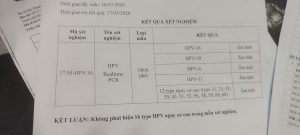 69e9d38b684d1 dau bung duoi