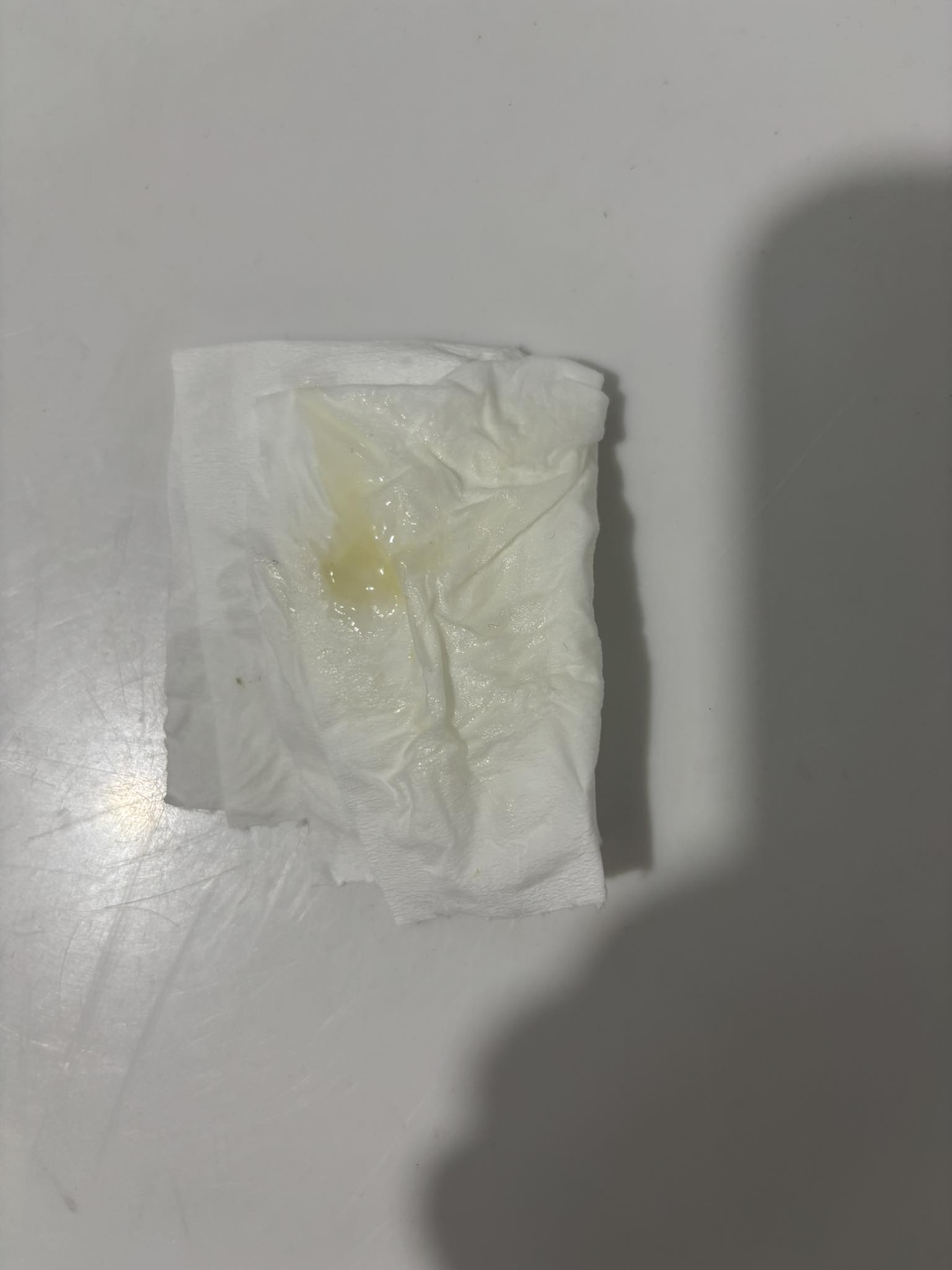 Gần ngày kinh bị ra dịch vàng có sao không? 2 706802504 974465925512005 7040923239998869266 n