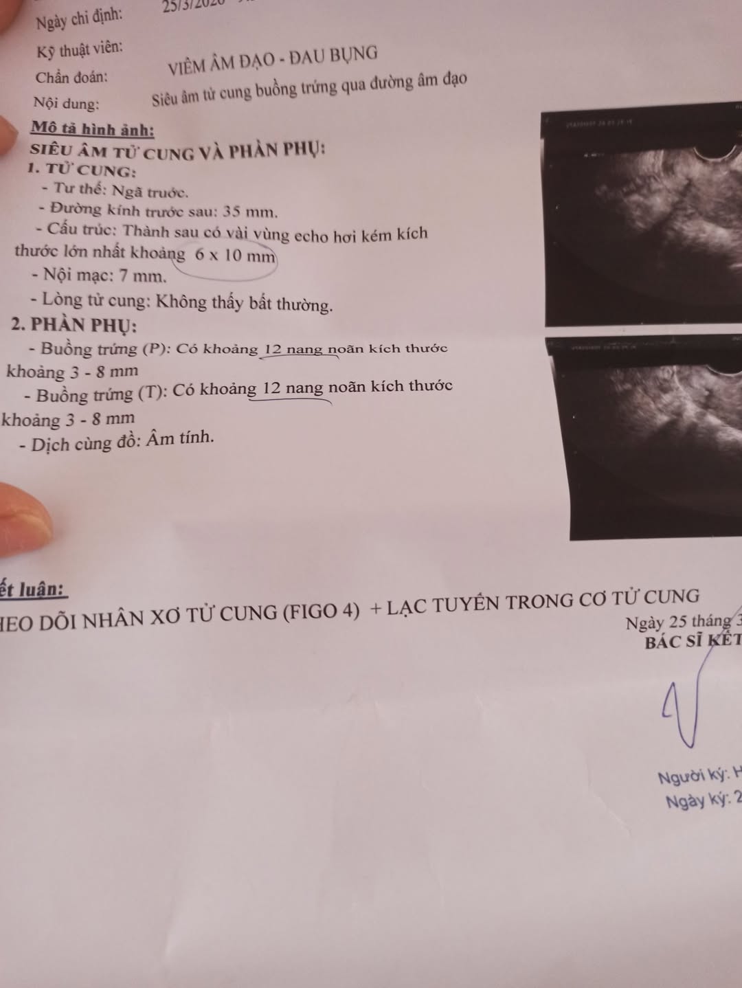 Bị viêm phụ khoa, đang đặt thuốc có ảnh hưởng đến khả năng mang thai không? 2 657330448 1500286215038210 3134349428864547905 n