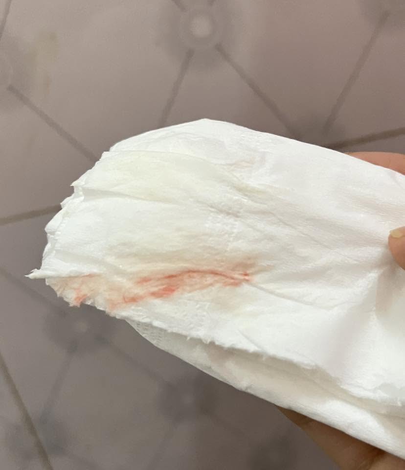 Khám phụ khoa về bị ra ít máu có sao không? 2 723087060 1494204209112097 532224294425389598 n
