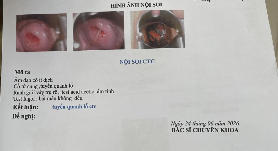 Tại sao khám ra lộ tuyến nhưng bác sĩ không kê thuốc điều trị? 2 727467177 985213294414117 6093524722060256729 n